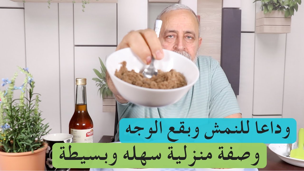 علاج النمش والبقع الداكنة وصفه منزليه من مجربات زمان