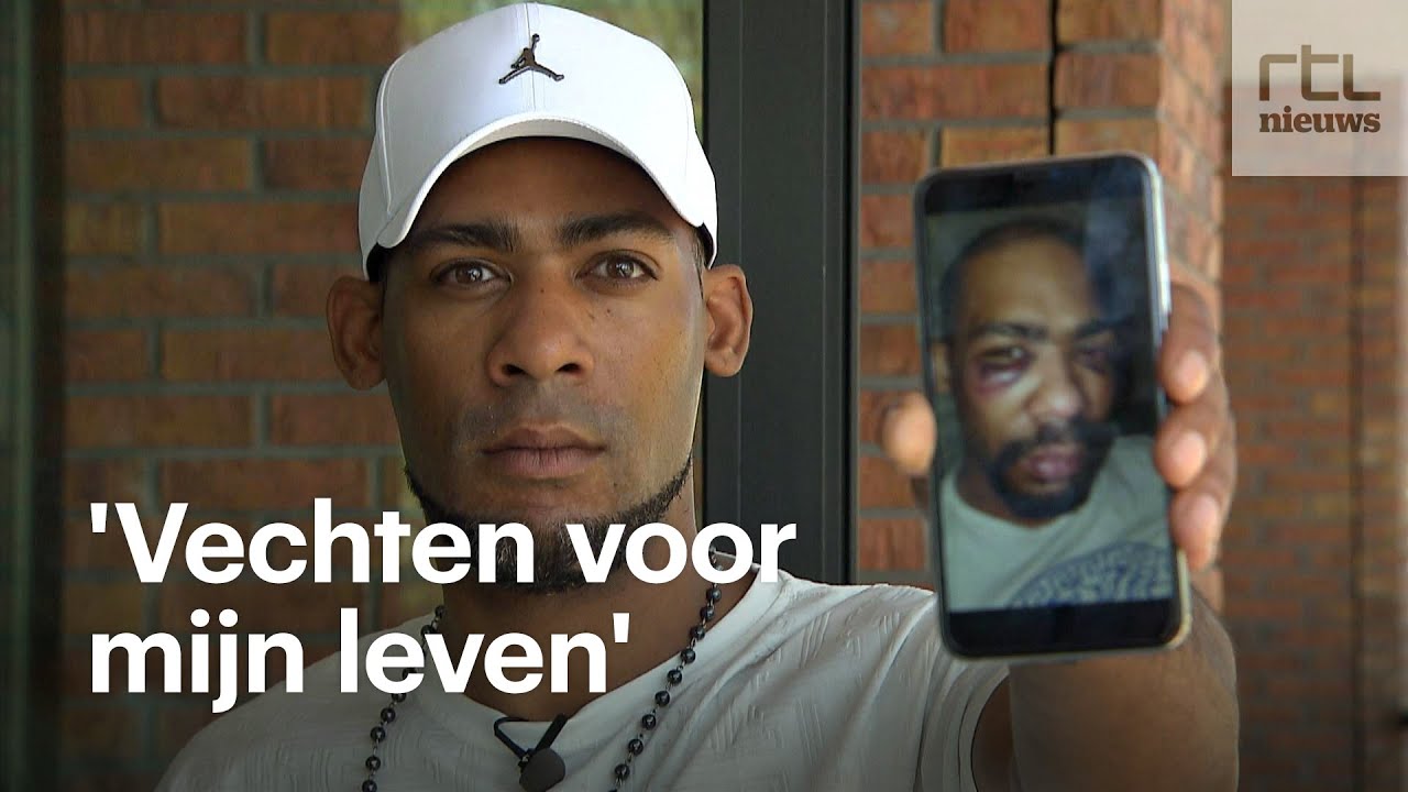 Rushen werd bruut aangevallen door politiehond