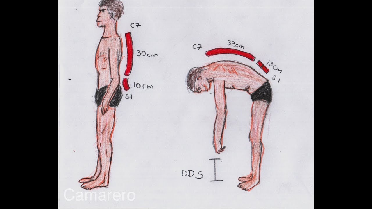 Prueba de distancia dedos suelo,  exploraci&oacute;n de columna vertebral.
