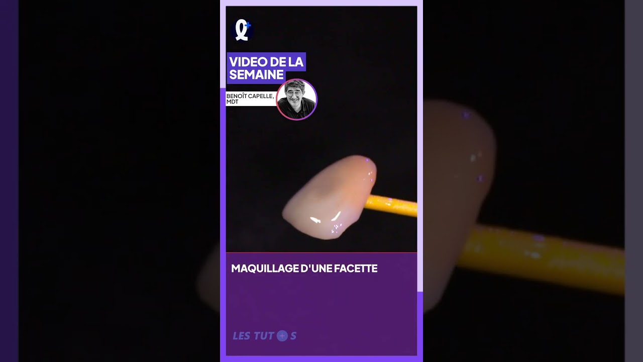 Les Tutos &ndash; Maquillage d&rsquo;une facette | Beno&icirc;t Capelle, MDT