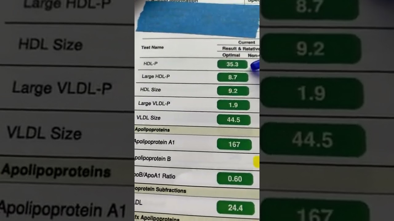 How To Review & Interpret Your Advanced Lipid Profile