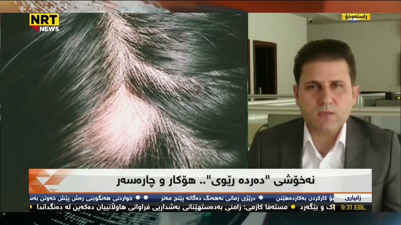 ئایا نه‌خۆشی 