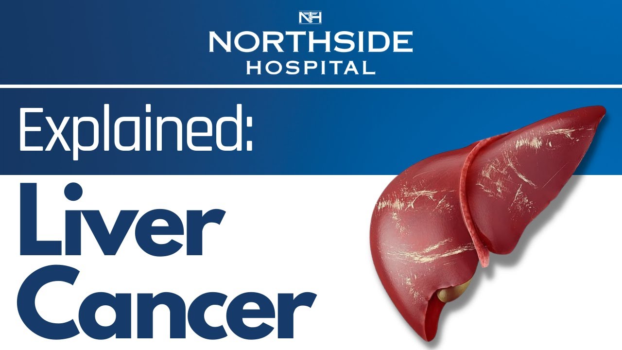 Liver Cancer Explained- Symptoms & Prevention of Liver Cancer