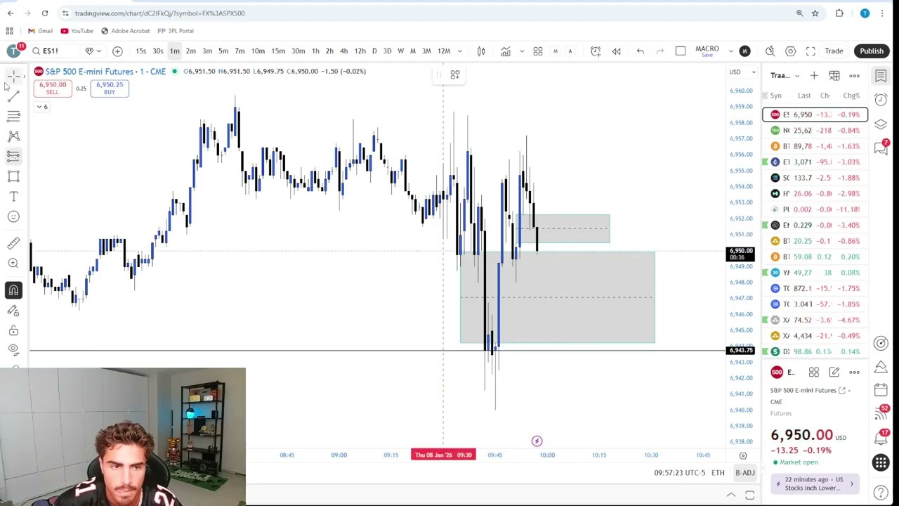 Live Day Trading Losing $97,421 (I AM DOWN 122K THIS WEEK)