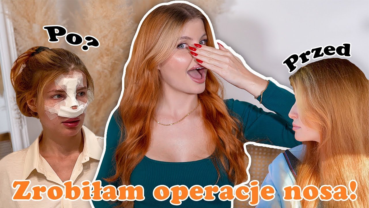 OPERACJA NOSA: VLOG DZIEŃ PO DNIU I ODPOWIEDZI NA WASZE PYTANIA