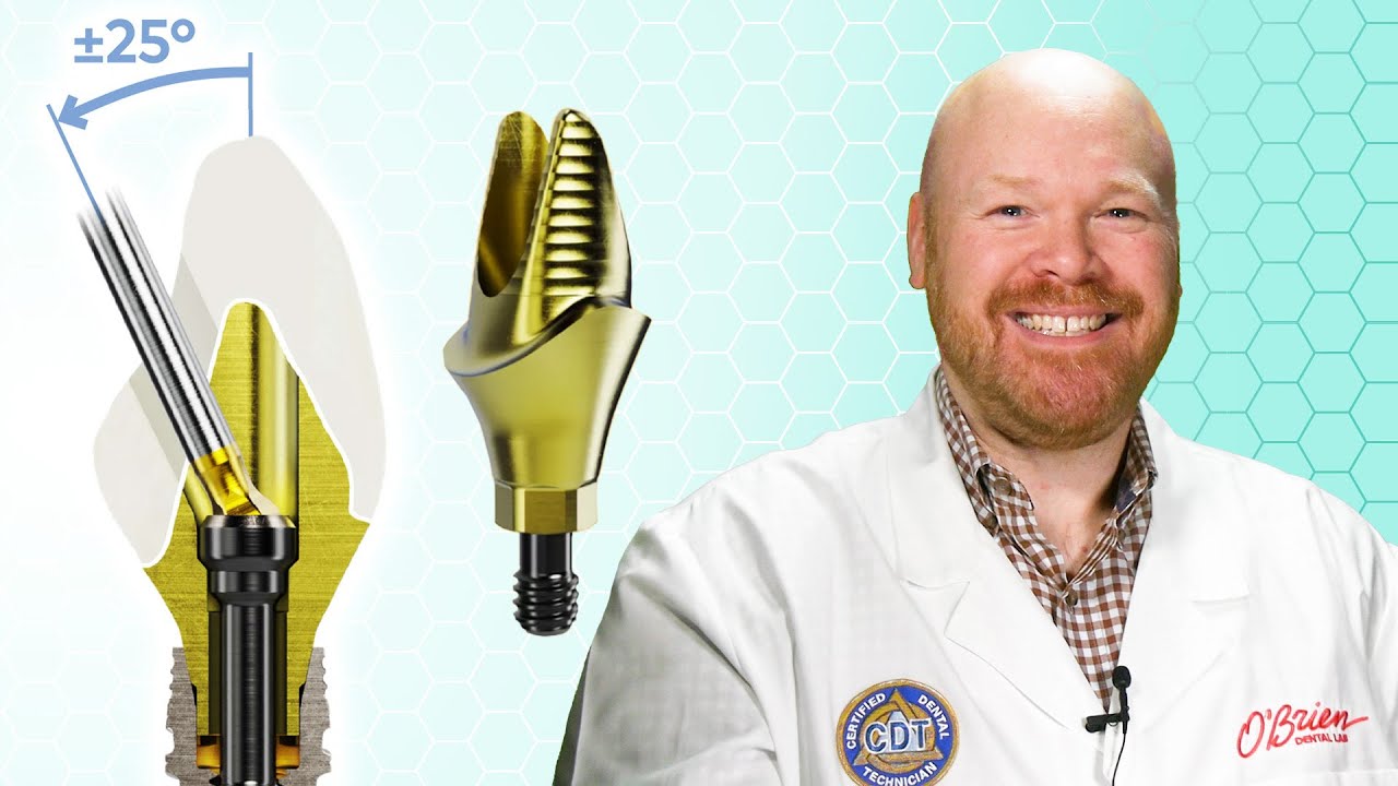 Nobel ASC Custom Titanium Abutments Are Finally Here!