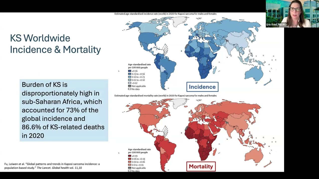 KSHV, Immunity and Cancer: Harnessing Insights into Viral Pathobiology for Therapeutic Intervention