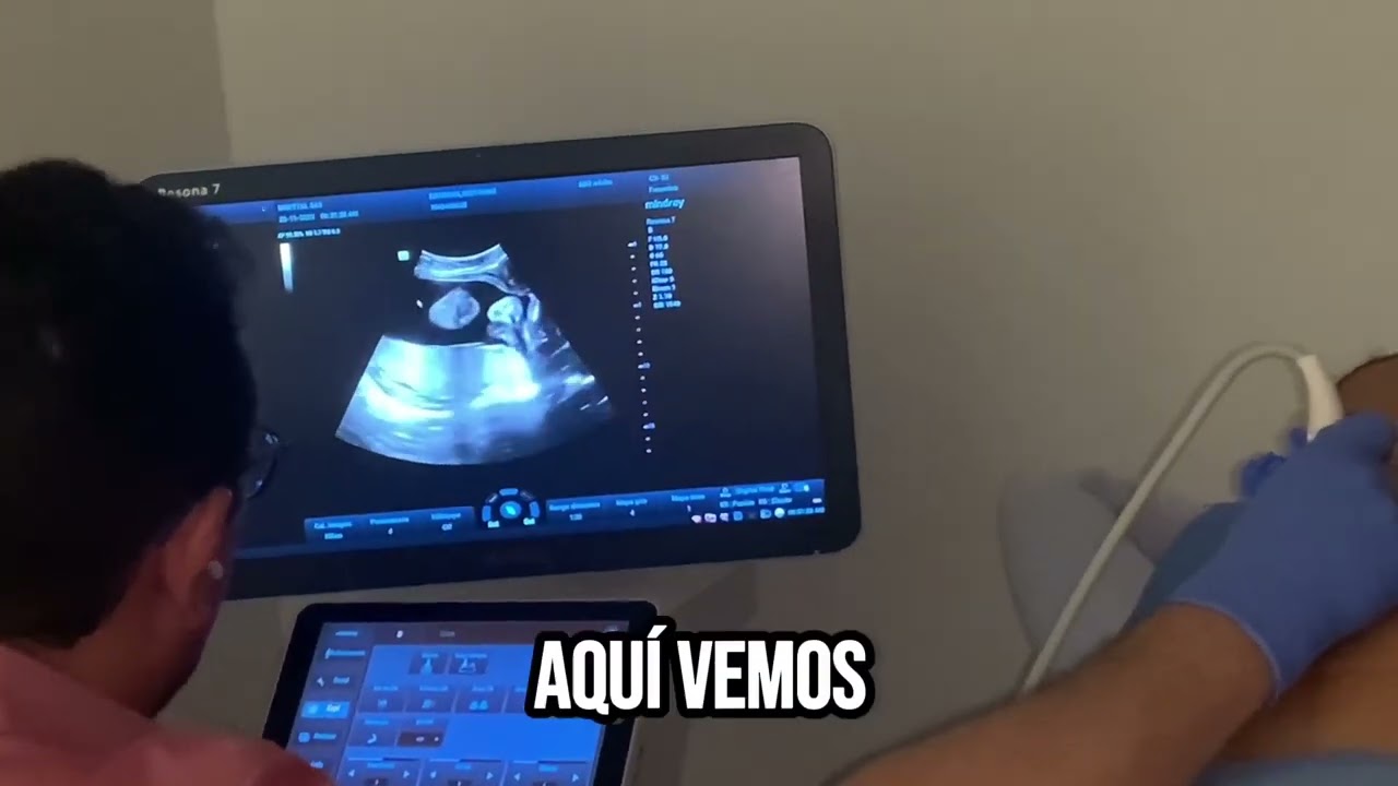 Embarazo alto riesgo obstetrico, amniocentesis por alteración de crecimiento fetal.