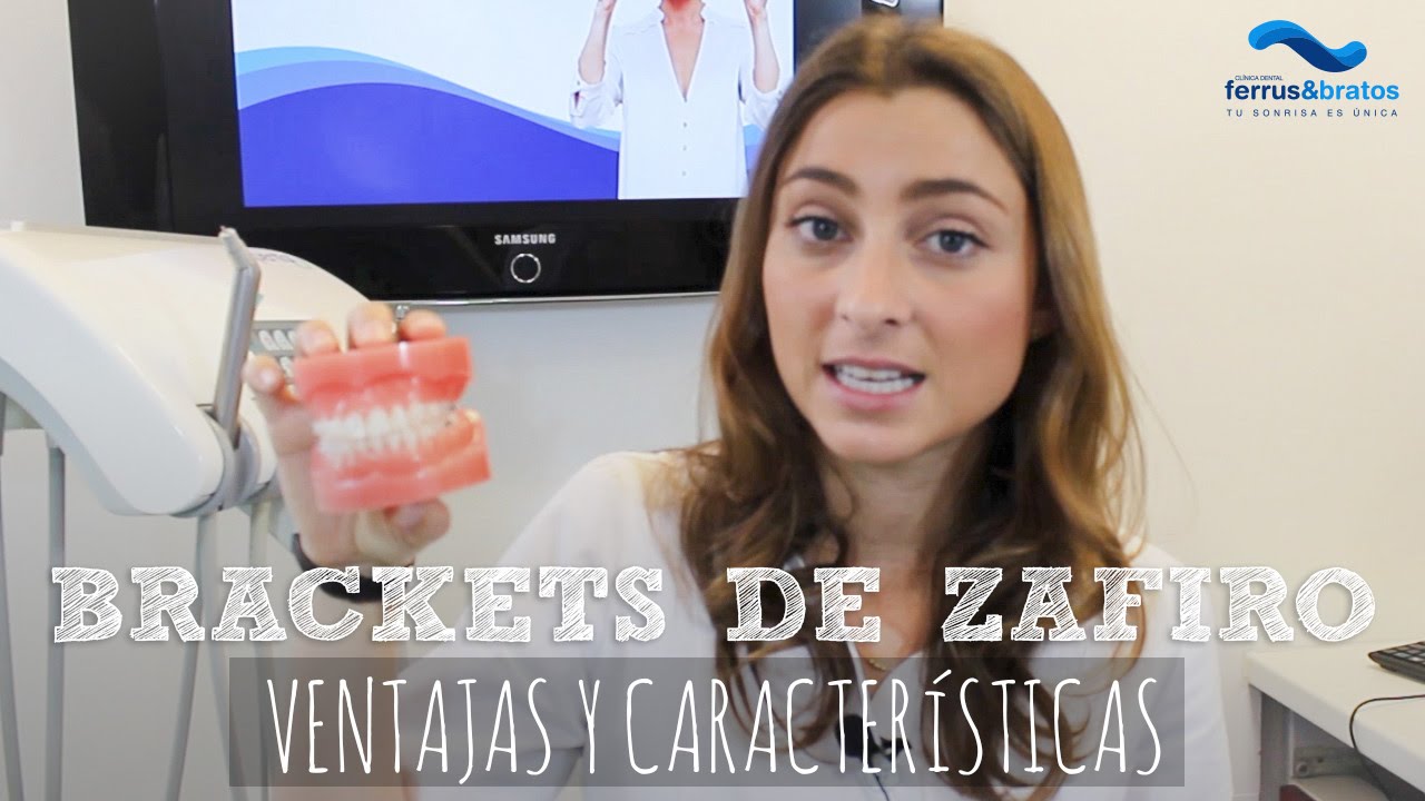 Brackets Zafiro, ventajas y caracter&iacute;sticas