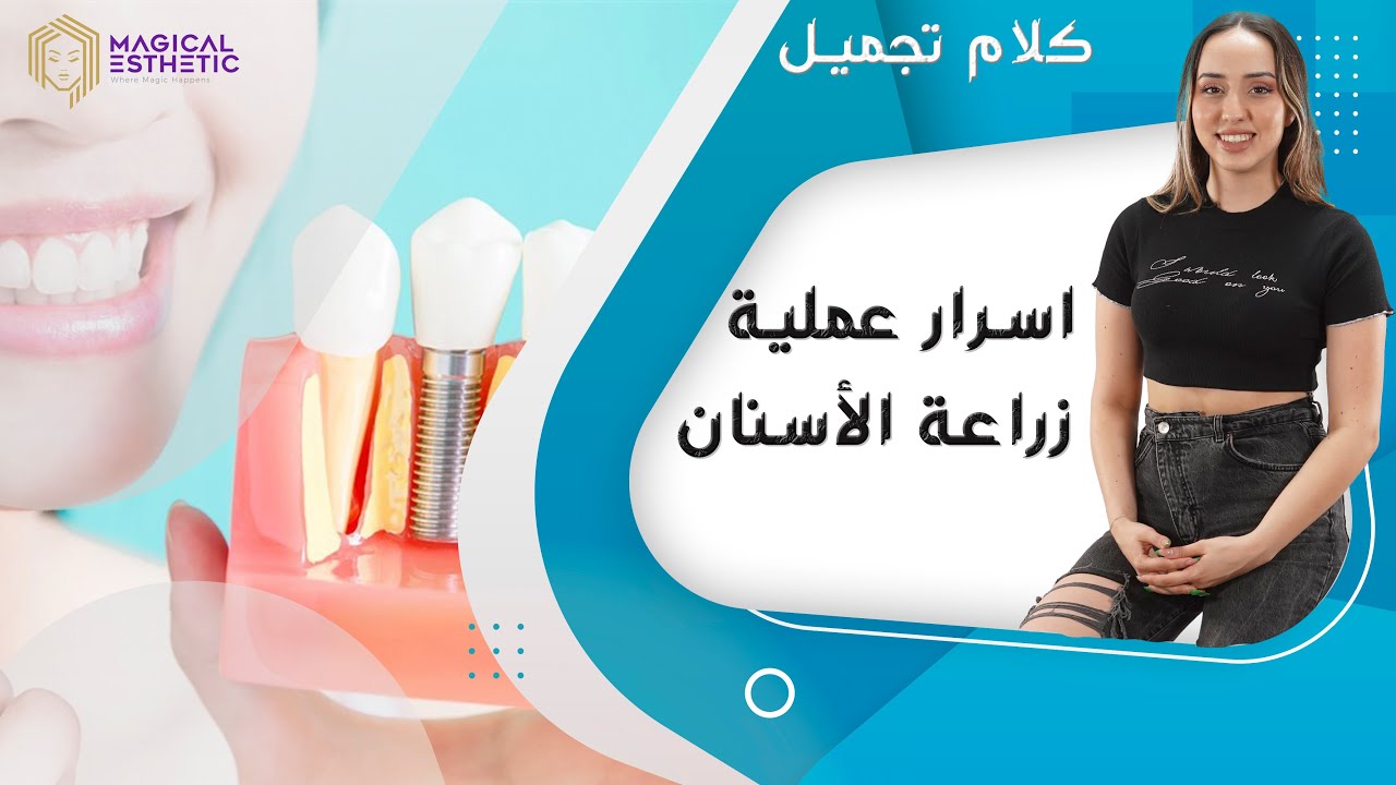بعض أسرار زراعة وتجميل الأسنان - كلام تجميل مع ندى عبيد