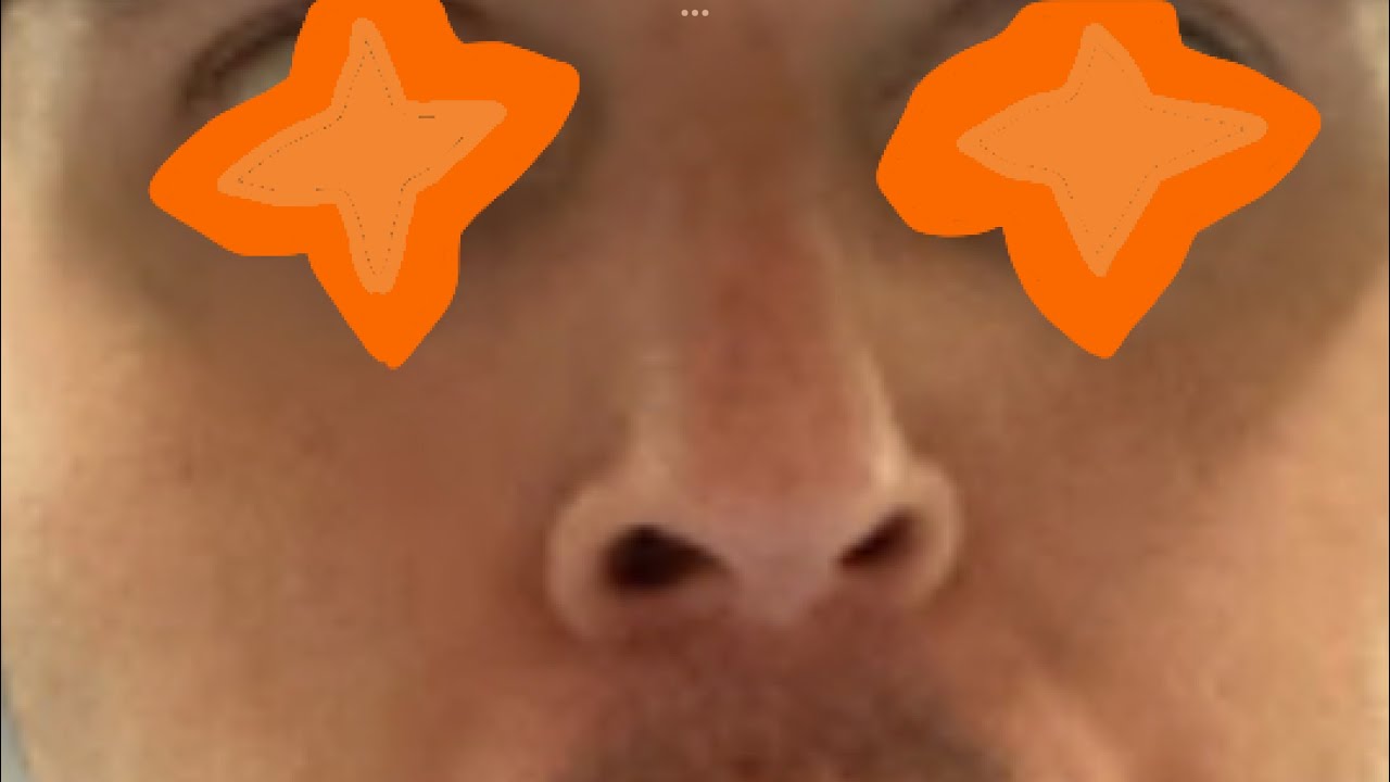 Tal_on compilation (EARRAPE)