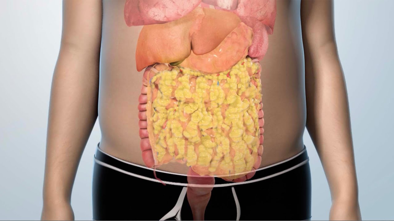 Treatment Options for Type 2 Diabetes