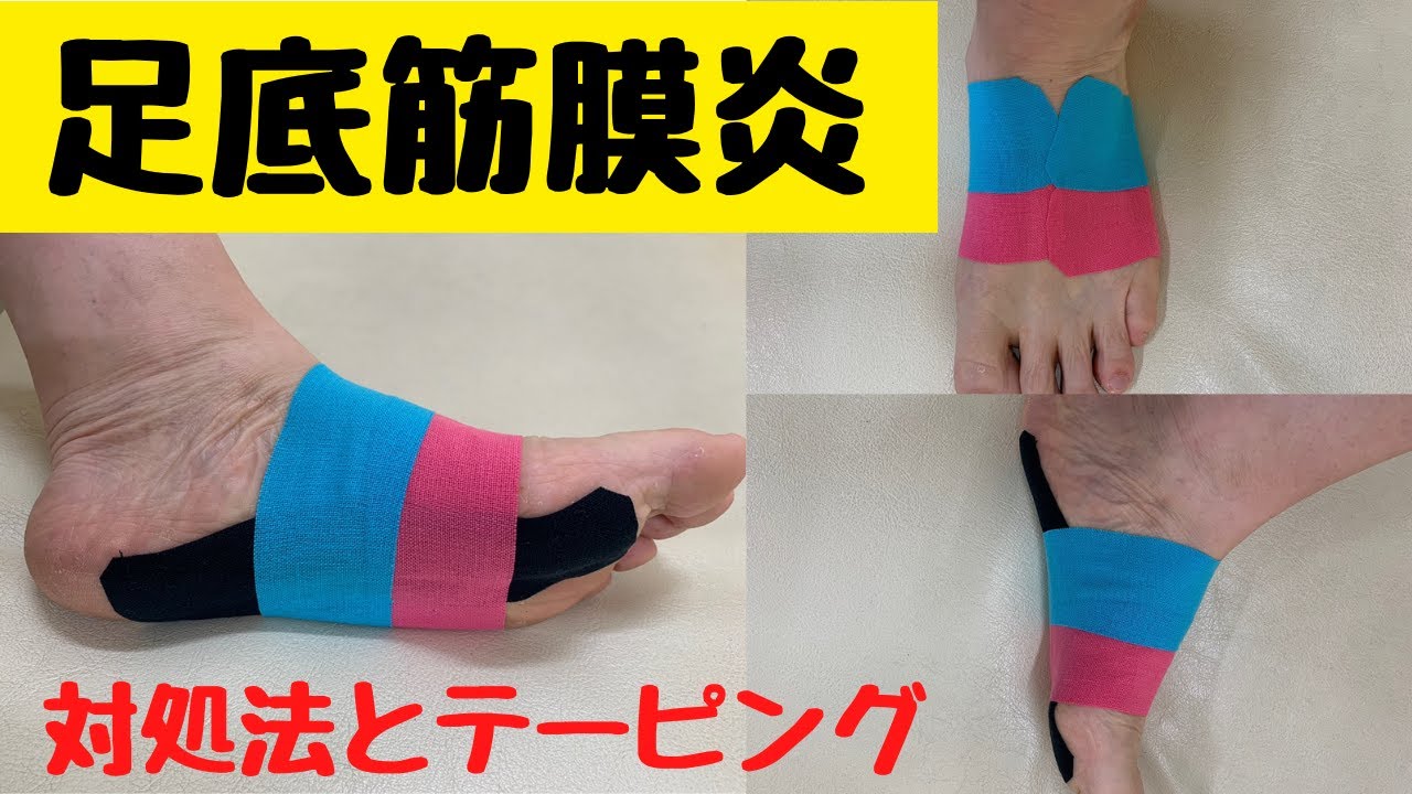 足底筋膜炎（足の裏の痛み）対処法とテーピング