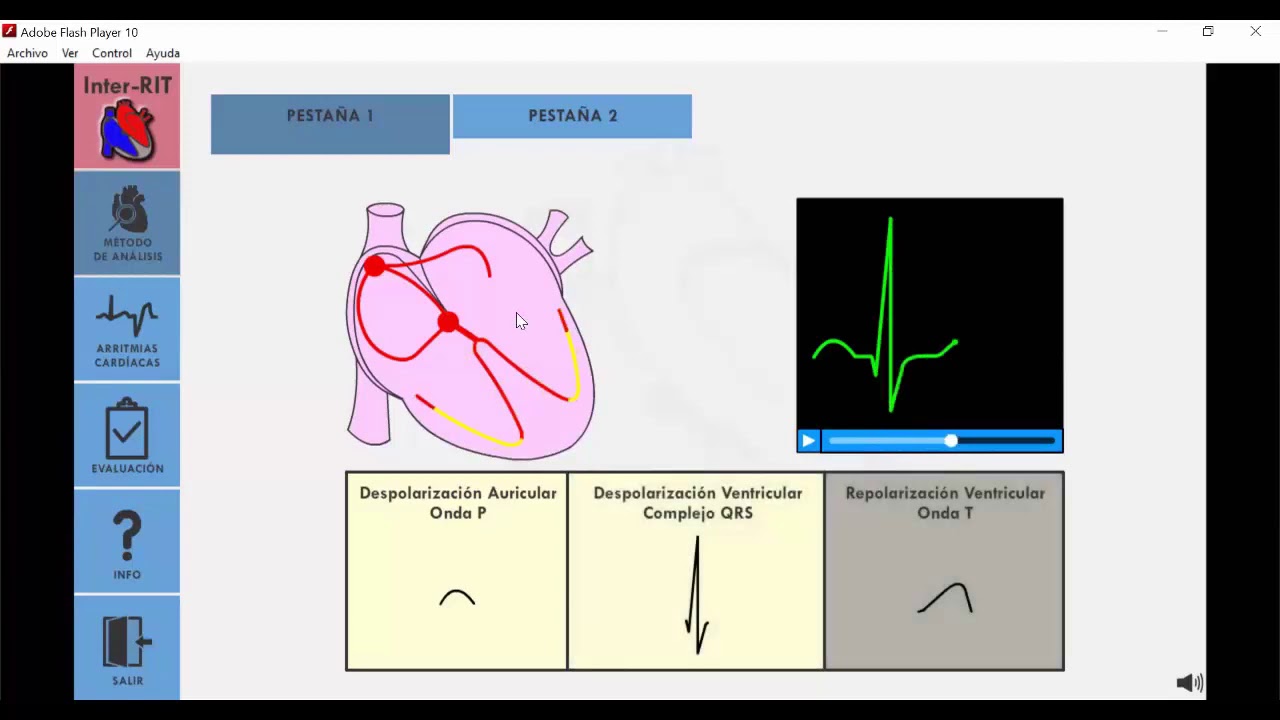 ARRITMIAS CARDIACAS, parte 1