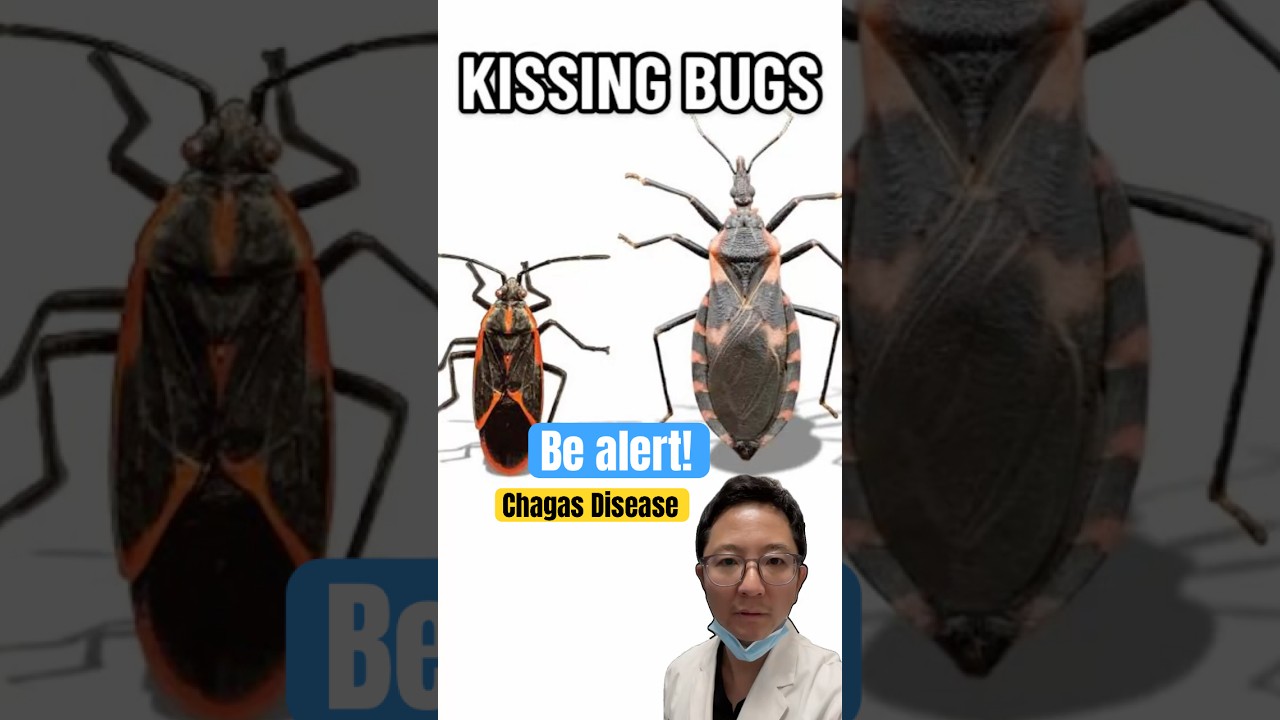 Chagas Disease AKA Kissing Bug Disease  Explained in 60 Seconds