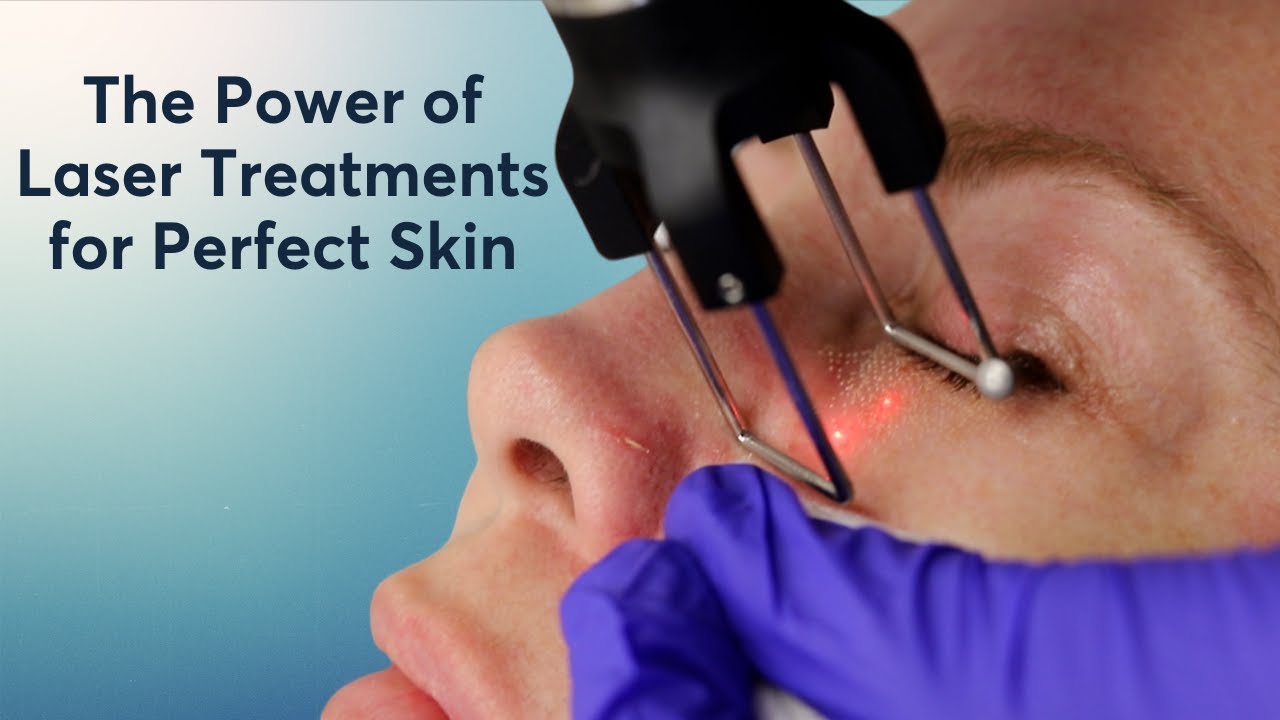 Wrinkles? Pigmentation? Stretch marks? Our Top Laser Treatments for All Skin Concerns