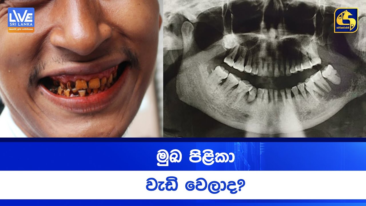 මුඛ පිළිකා වැඩි වෙලාද?