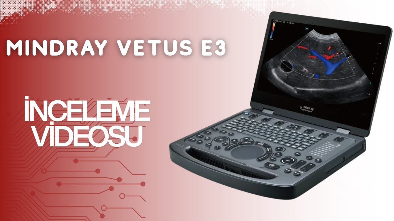 Mindray Vetus E3 İnceleme Videosu