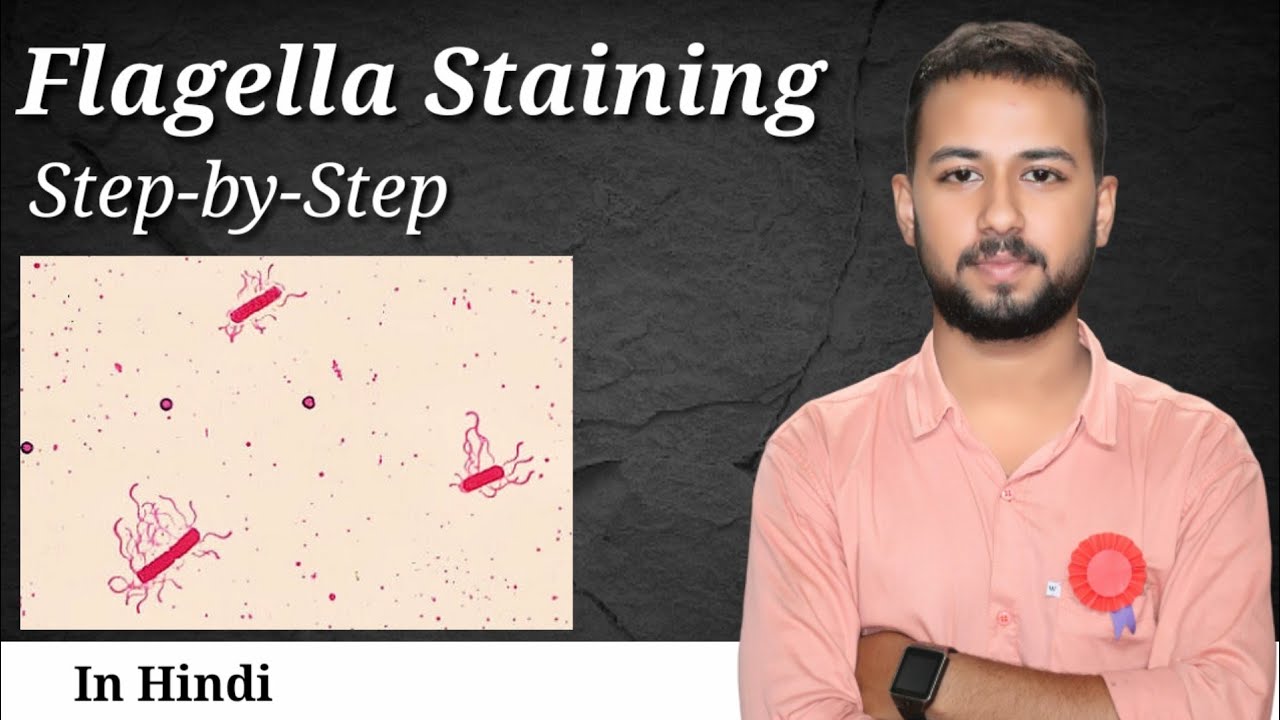 Flagella staining by leifson method | flagella staining procedure | flagella staining microbiology