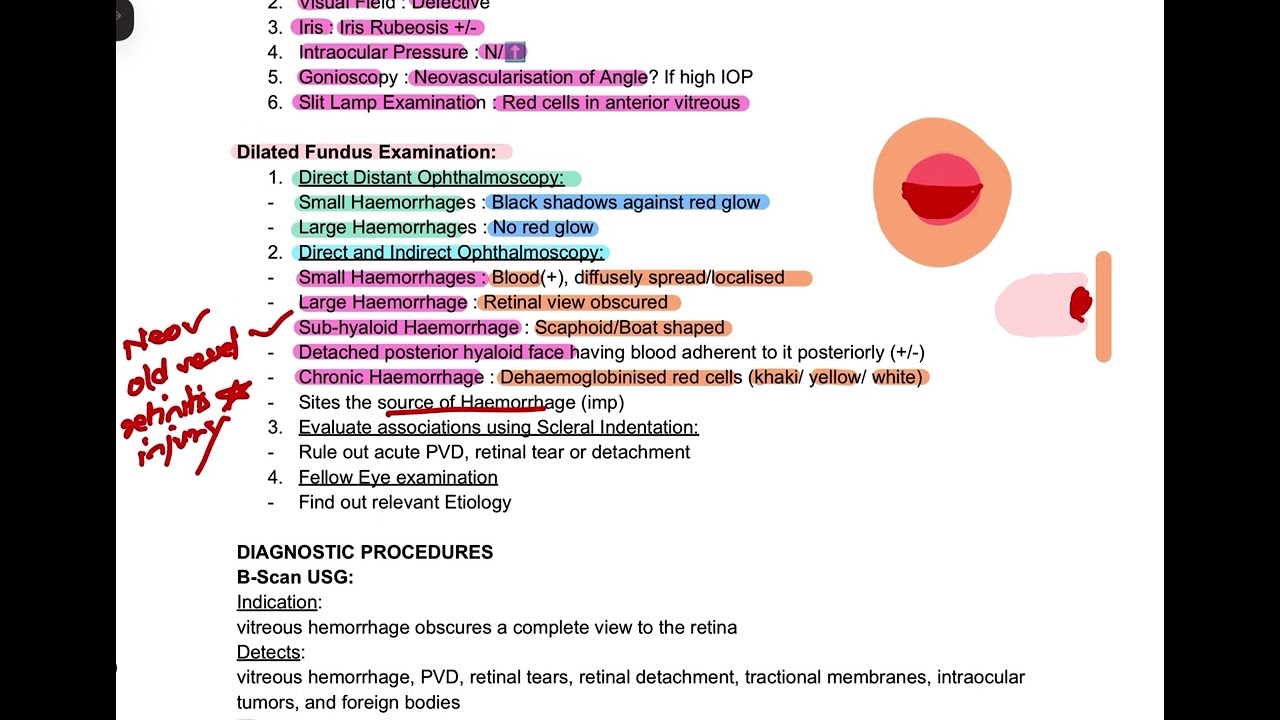 VITREOUS HAEMORRHAGE MBBS OPHTHALMOLOGY EXPLAINED