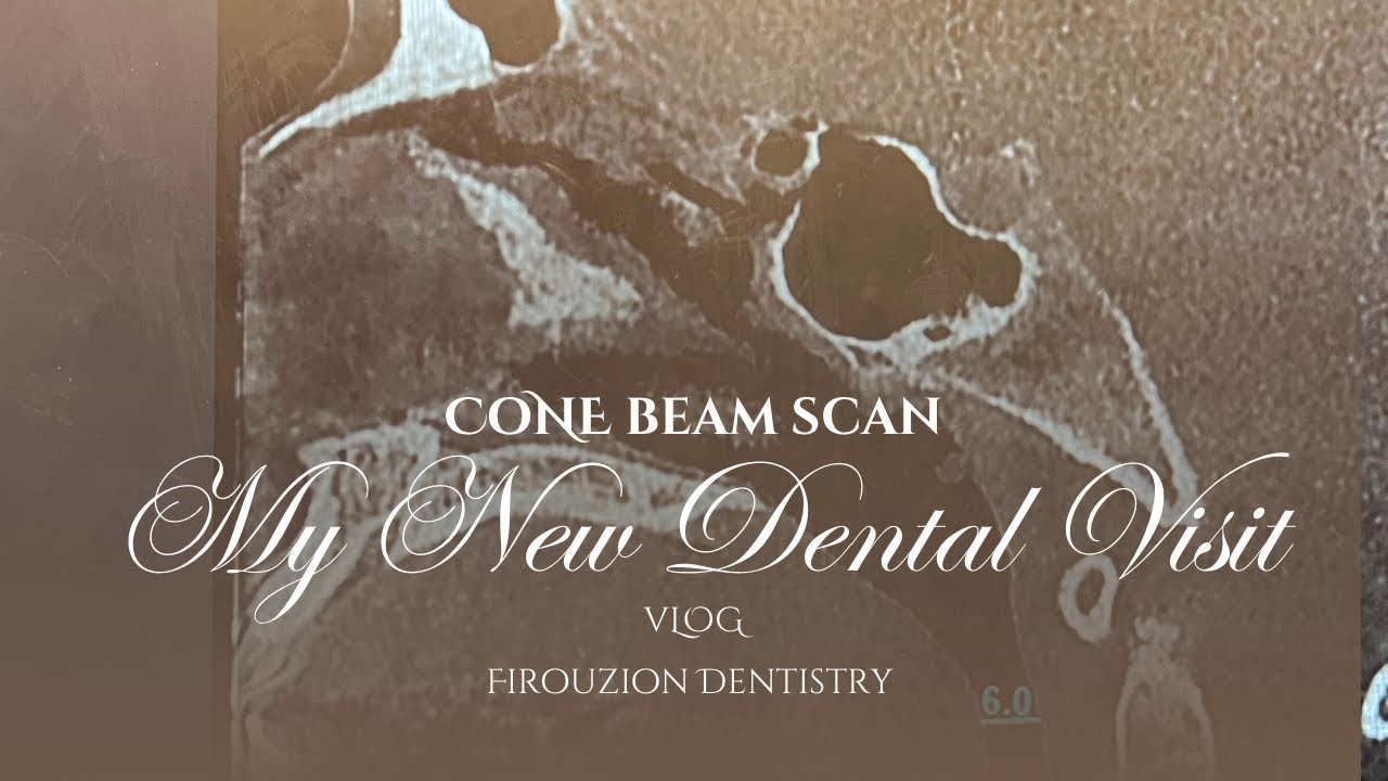 NEW DENTIST VLOG: Cone Beam Scan