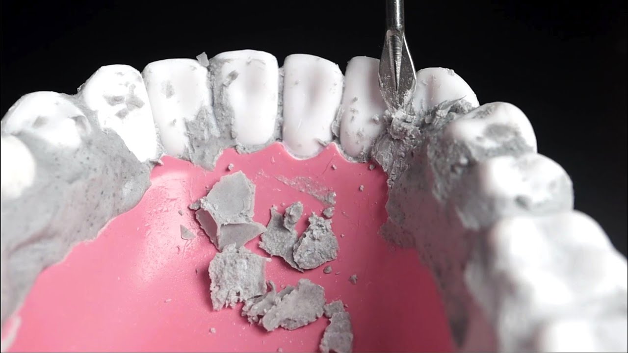 ACMP Удаление зубного камня , чистка🦷Dentist Cleans Your Teeth!