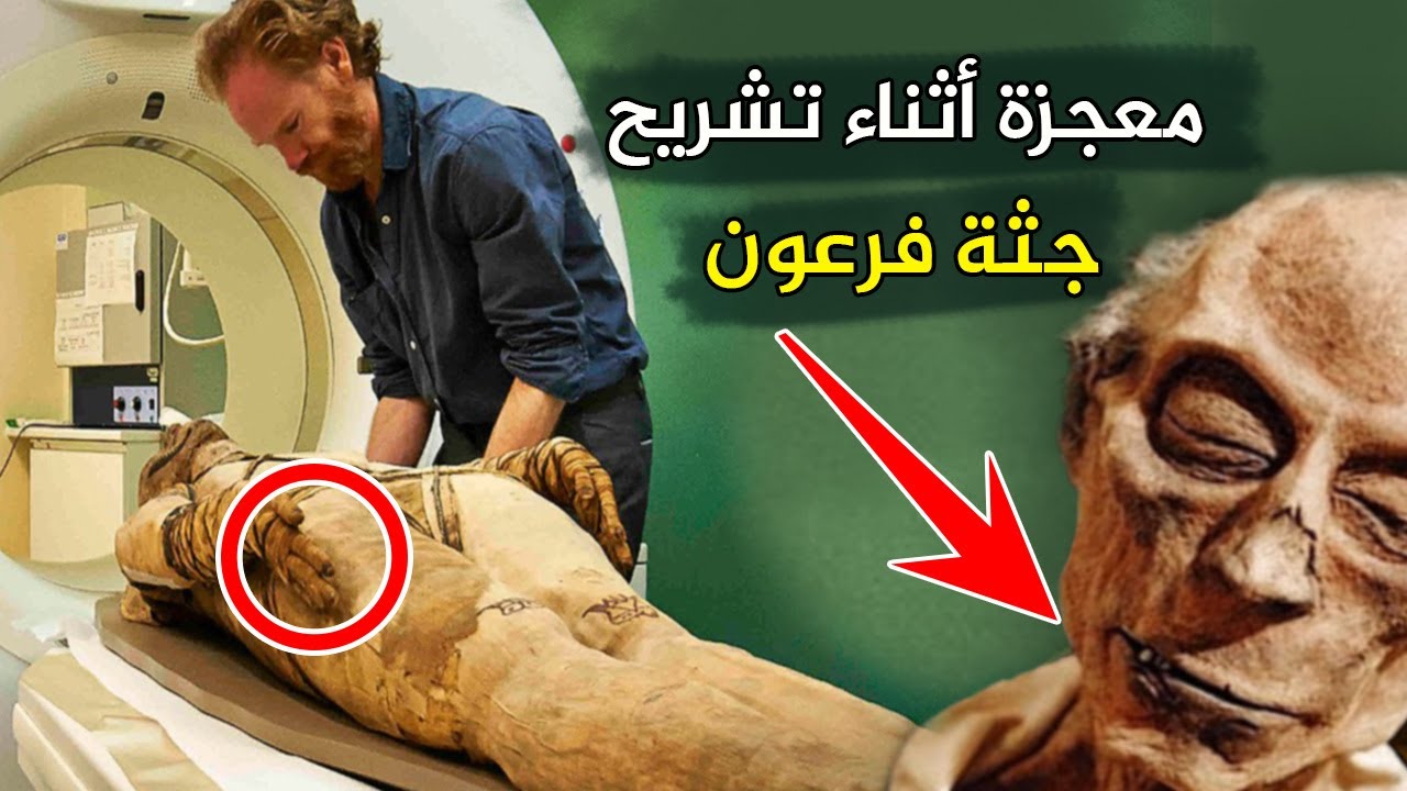 معجزة تظهر أثناء فحص فرعون (سيدنا موسى) جعلت عالم فرنسي يدخل الاسلام