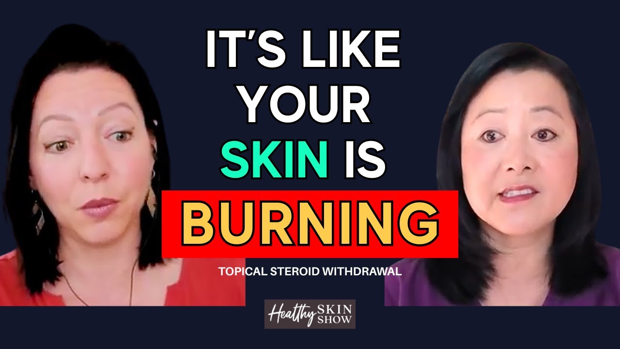 THIS Can Help You Heal Topical Steroid Withdrawal (TSW) | Olivia Hsu Friedman