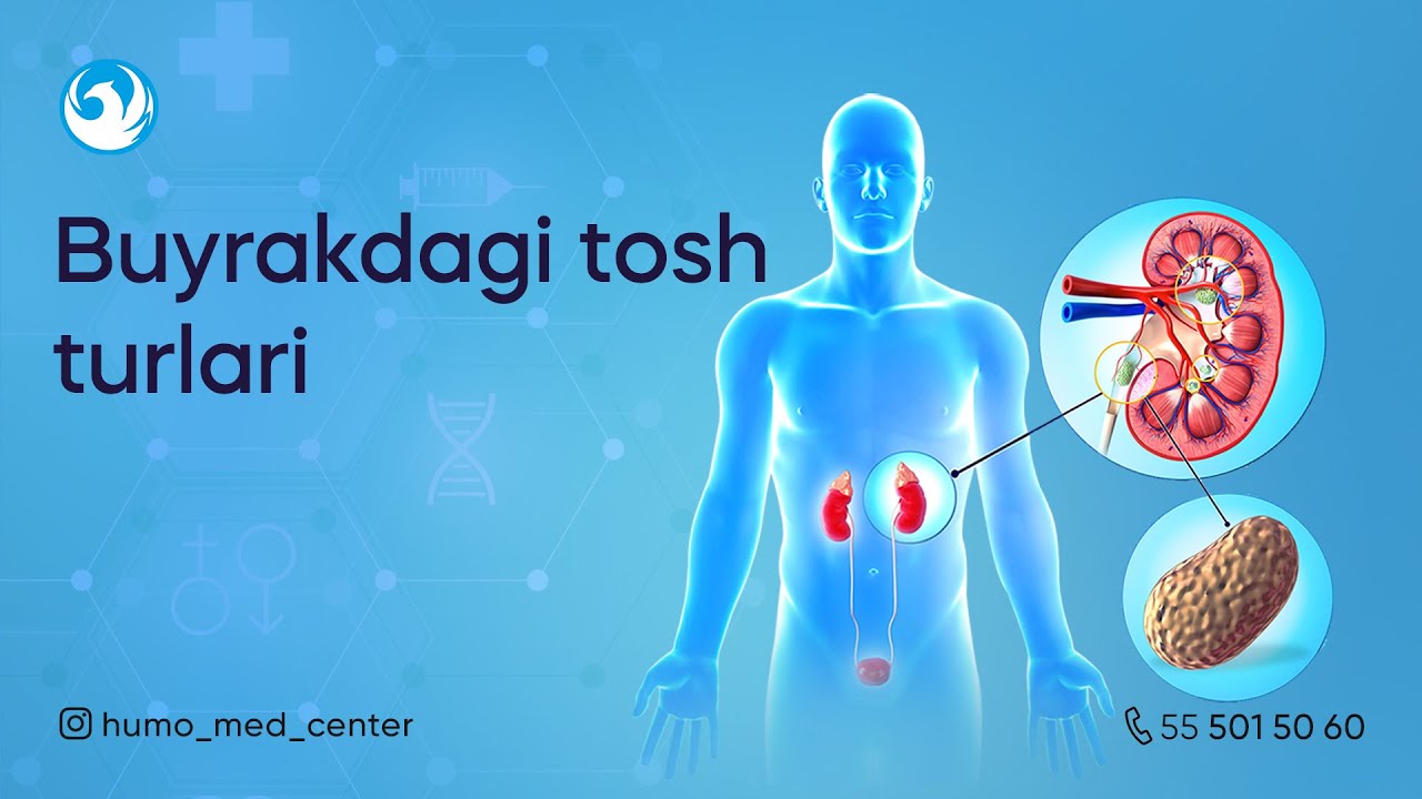 BUYRAKDAGI TOSH TURLARI