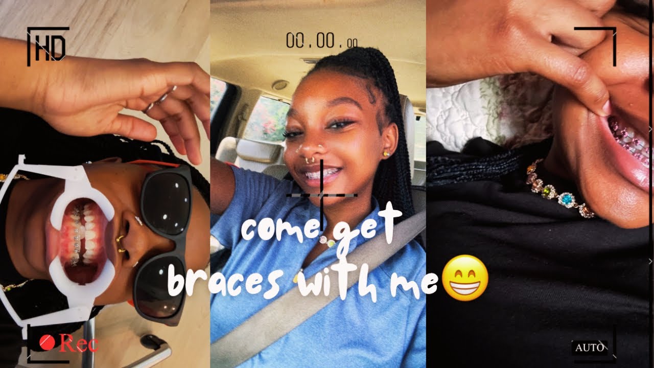 come with me to get my braces 😅😁