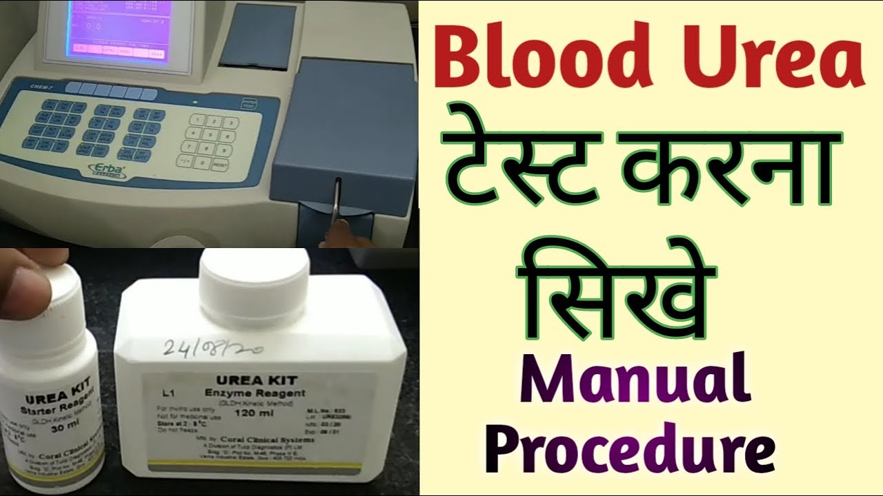 Blood urea टेस्ट करना सिखे | Estimation of serum urea | blood urea test procedure