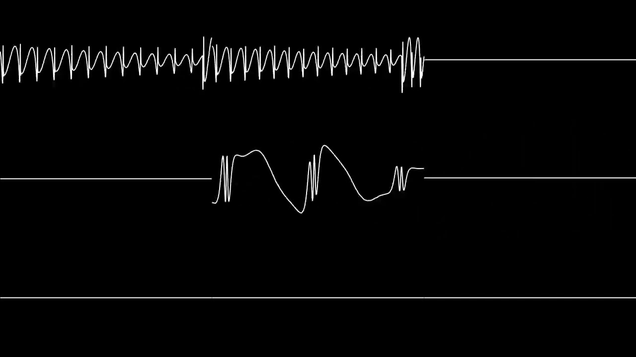 Kirby 64: The Crystal Shards - Boss Battle Theme (Sega Genesis Cover)