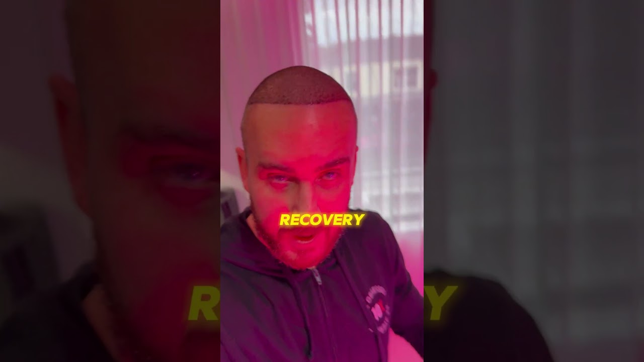 Day 5 Hair Transplant Progress