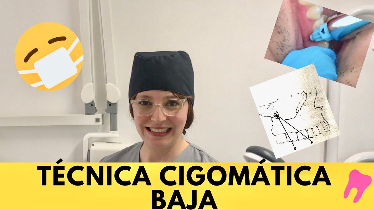 Técnica Cigomática Baja