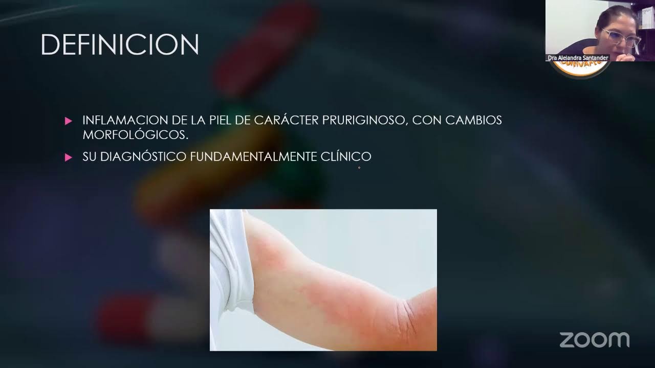 Terapia Farmacológica en Patologías Menores