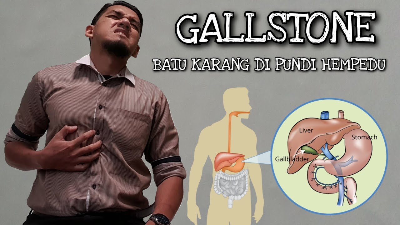 Gallstone ; Is It Dangerous?? || BATU KARANG Pundi Hempedu ||