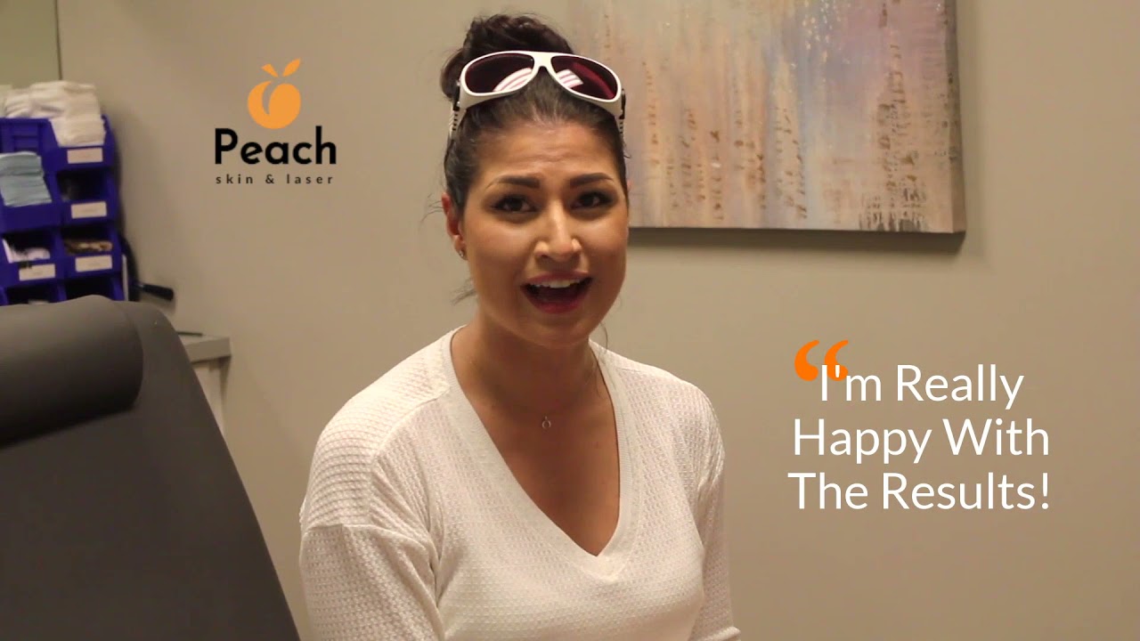 Laser Hair Removal at Peach Skin & Laser!