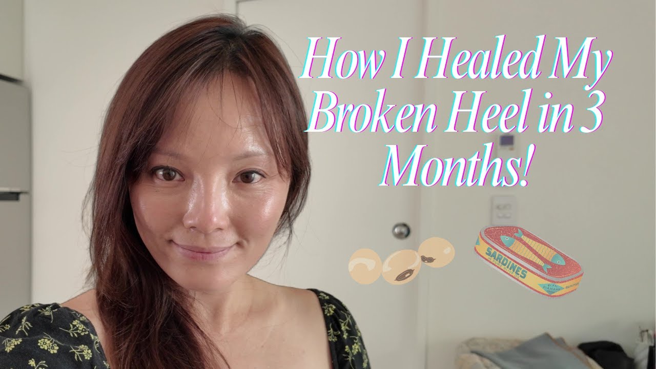 Here’s What I Ate After ORIF Surgery | Healing Calcaneus