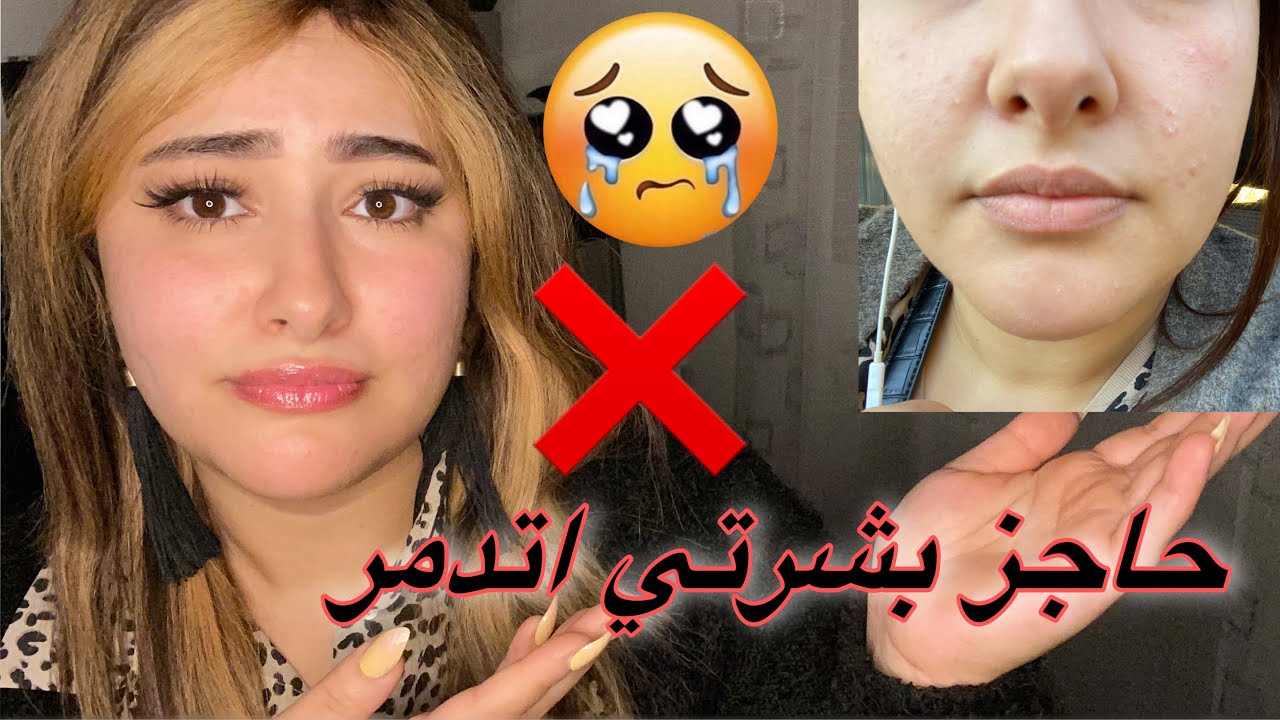 ازاي عرفت ان حاجز بشرتي اتدمر 😭وايه هو #حاجز_البشره وطرق العلاج الصح#skincare #بشرتي#بشره_صحيه