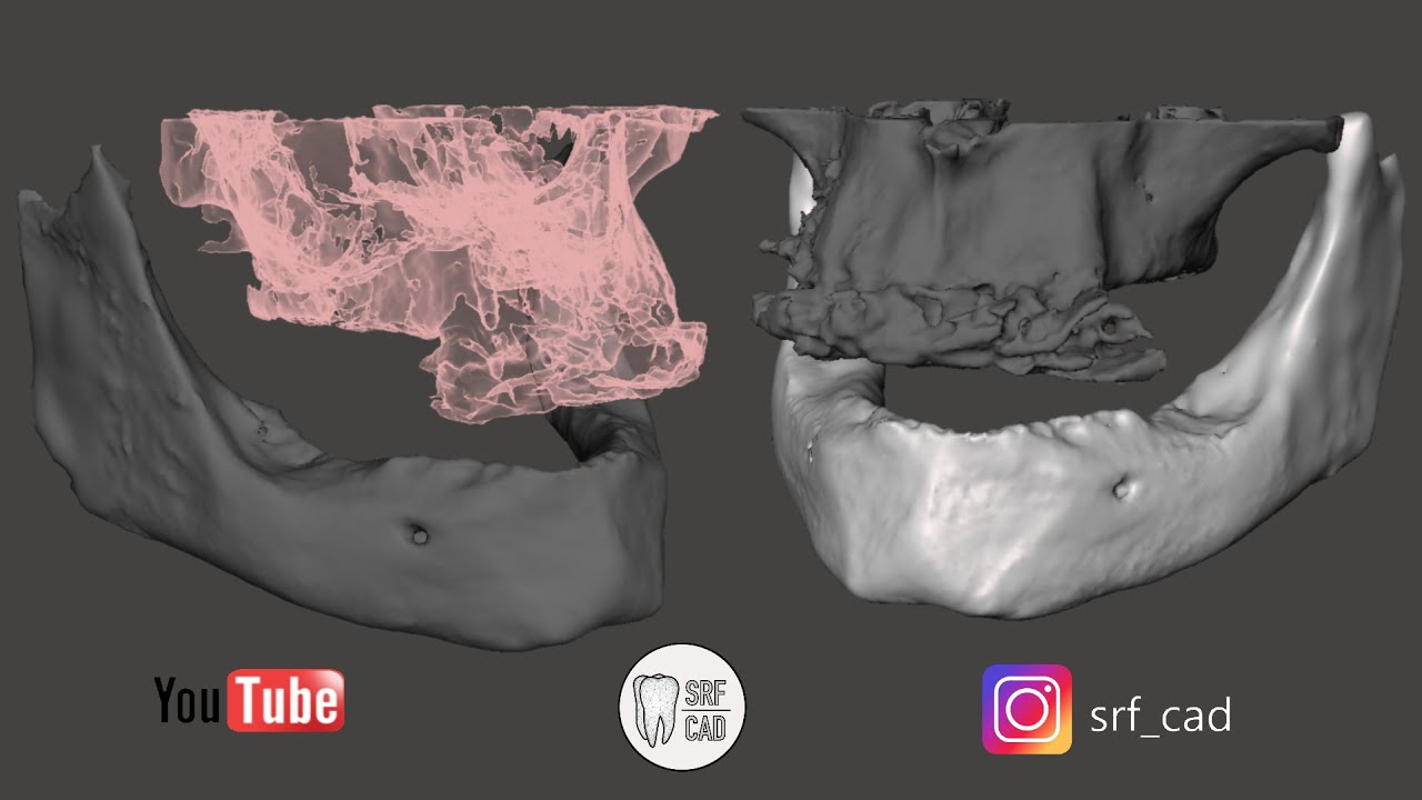 3D SLICER MESHMIXER DENTAL : Tutorial come convertire un file DCM in STL  DICOM CBT