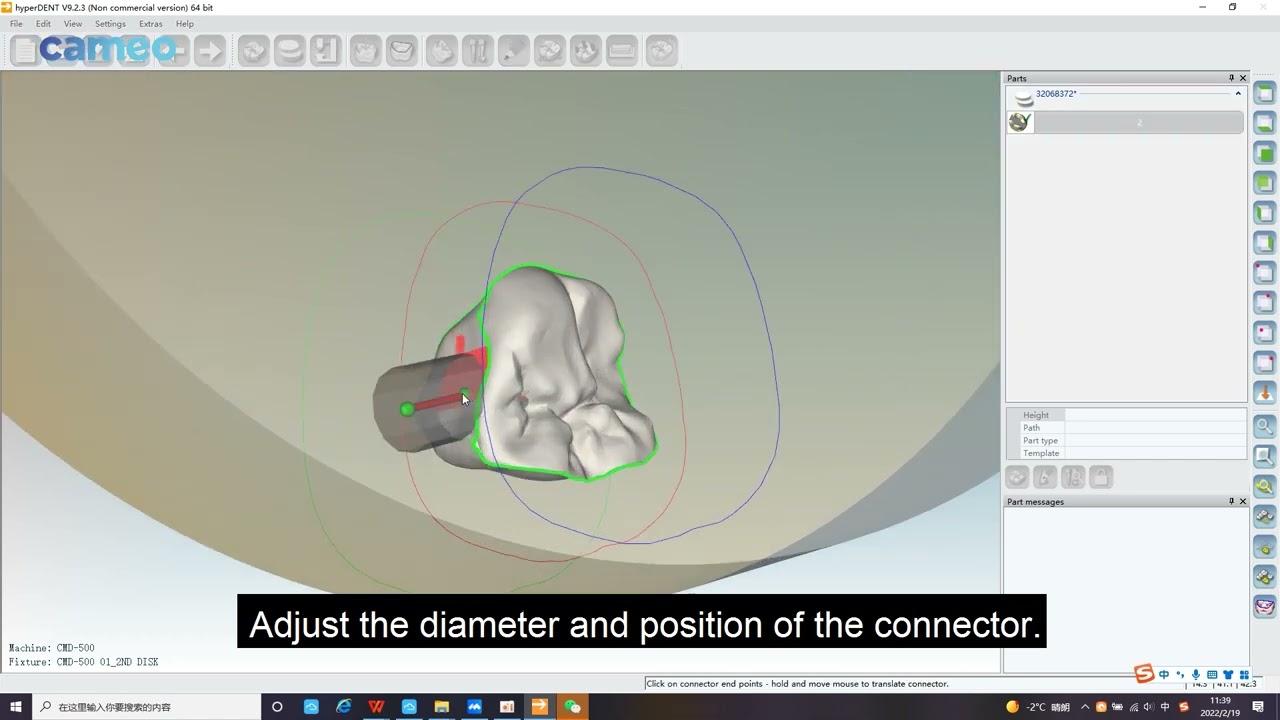 Aidite CMD 500 Software Nestting Guidance Video: Inlay Hyperdent