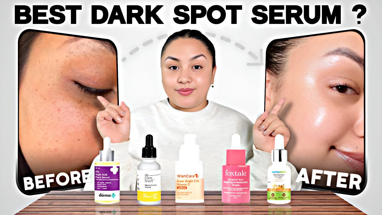 I Tested 5 Dark Spot Serums Under ₹700|Which Works Fast?😱