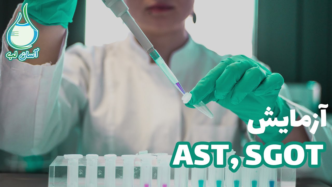 ASTتست های کبدی  | آزمایش خون کبد چرب و تشخیص آن چگونه هست ؟ | آزمایش