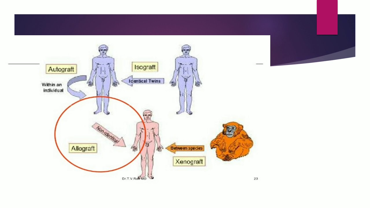Immunology of transplantation (అవయవ మార్పిడి లో అసం క్రామ్యత) by B.Sreedevi