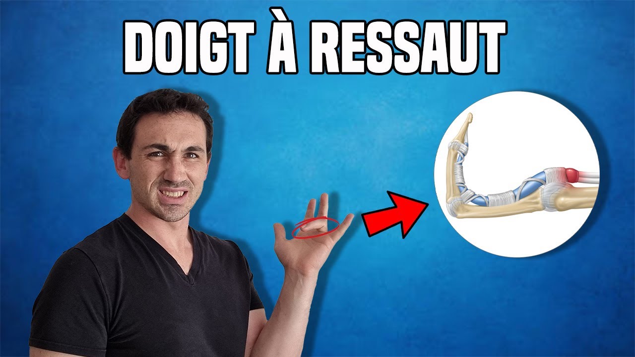 SOLUTIONS CONTRE LE DOIGT À RESSAUT : EXPLICATION ET EXERCICES KINÉ