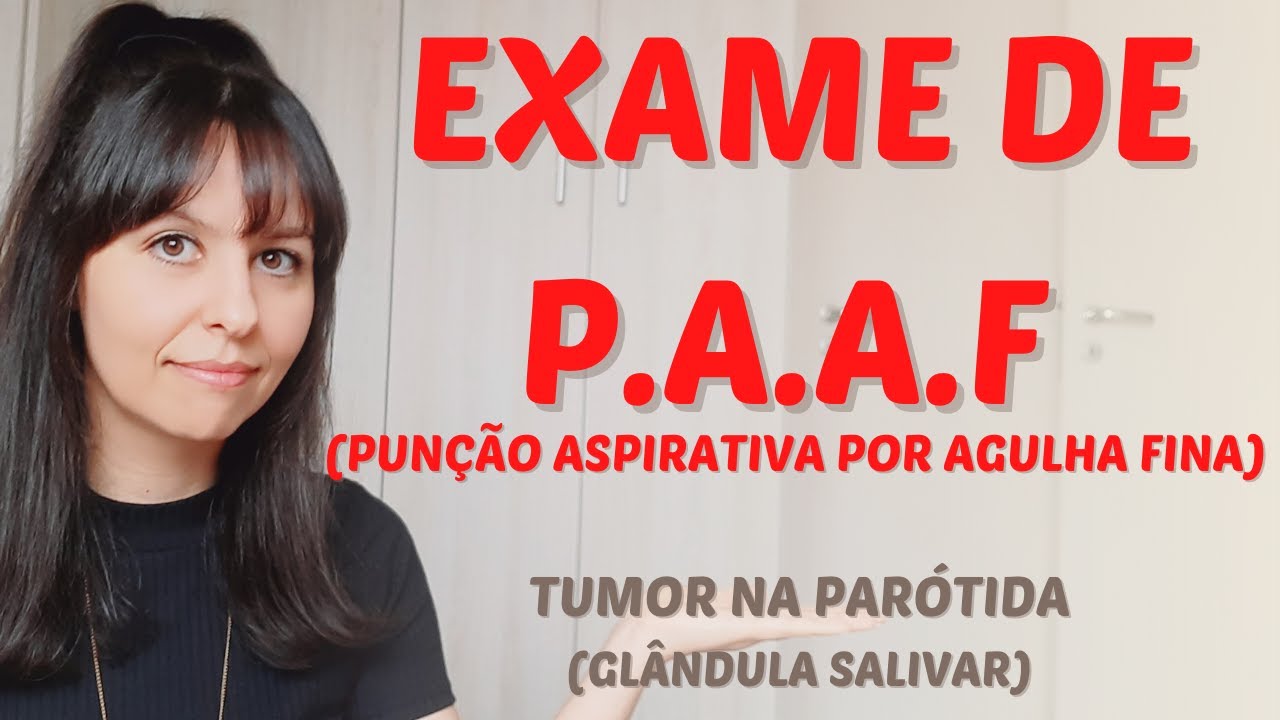 Exame de P.A.A.F puncão aspirativa por agulha fina tumor na parótida (glândula  salivar)