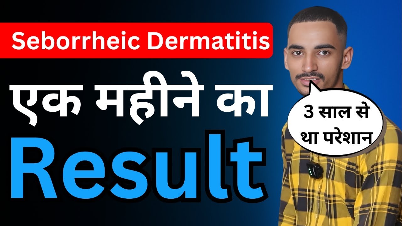 Seborrheic Dermatitis Treatment Success Story | 80% Relief in 1 Month with Ayurveda | VHCA