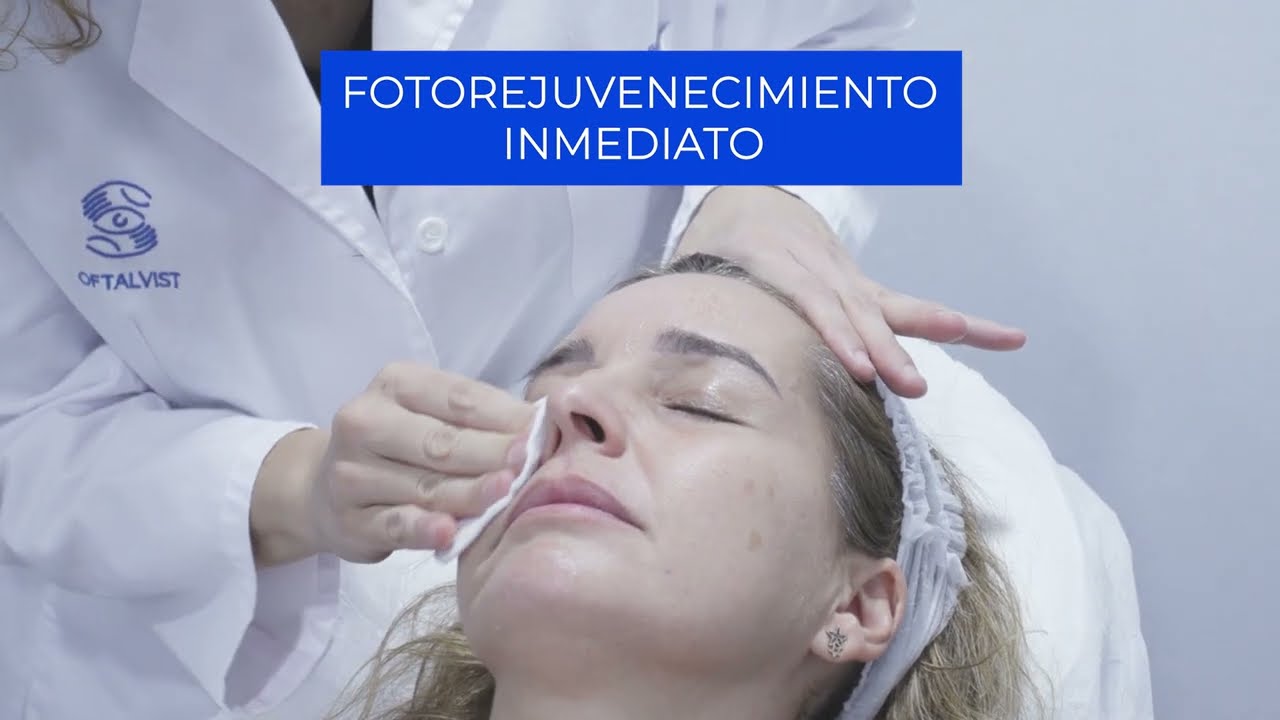 Luz pulsada IPL para eliminar  manchas ¿En qué consiste?