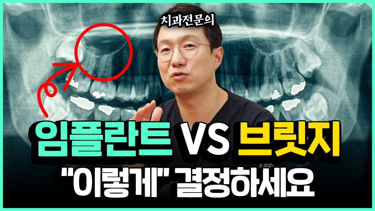 무조건 임플란트가 좋다고 하는 치과는 거르세요 ㅣ 상황별 임플란트 브릿지 고르는 방법