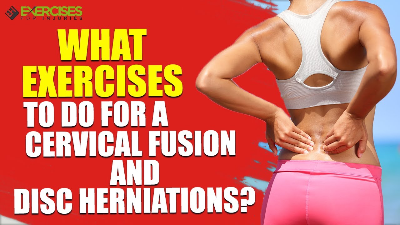What Exercises to do For a Cervical Fusion and Disc Herniations?